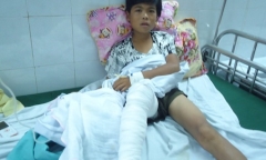 Bé trai 13 tuổi nghi bị hổ vồ mất bắp chân