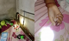 Bé gái 9 tuổi chết sau khi bị rắn hổ mang cắn lúc đang ngủ