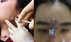 Ham làm đẹp giá rẻ, chị em 