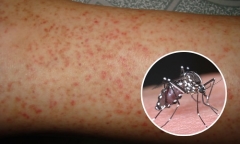 Hà Nội: 4 quận, huyện có chỉ số côn trùng sốt xuất huyết cao vượt ngưỡng