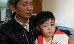 Đề nghị khởi tố vụ bé trai 10 tuổi bị bố đẻ và mẹ kế bạo hành