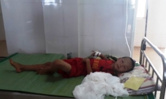 Nghệ An: Bé trai 8 tuổi nguy kịch vì bị ong vò vẽ đốt