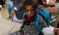 Xe buýt chở học sinh Yemen trúng tên lửa, ít nhất 43 người thiệt mạng