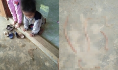 Hãi hùng cảnh học sinh nôn ra giun ngay trong lớp học