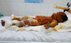 Tin tức đời sống mới nhất ngày 5/9/2018: Mẹ ngã quỵ khi nghe tin con bị lửa thiêu sống