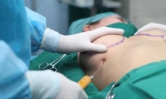 Nữ doanh nhân nhập viện khẩn cấp vì biến chứng sau ca nâng ngực ở nước ngoài
