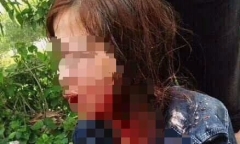 Triệu tập đối tượng dùng mảnh thủy tinh đâm vợ trọng thương trong đêm Giao thừa