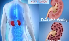 Suy thận dương, vấn nạn của đàn ông ngày nay
