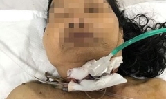 Phụ cháu mổ gà ăn lễ, bà trượt chân bị dao đâm xuyên cổ