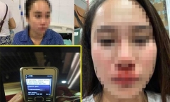 Vụ cô gái bị đánh ghen, lột đồ ở Hà Nội: Luật sư khẳng định không có bằng chứng ngoại tình
