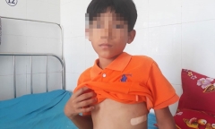 Xót xa bé trai 11 tuổi bị trâu húc gãy xương sườn 