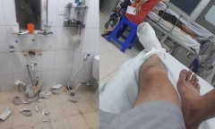 Chuyên gia cảnh báo chấn thương từ những chiếc bồn rửa trong nhà tắm