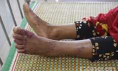 Một học sinh mắc 