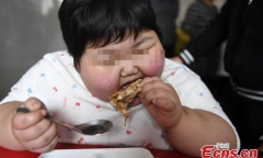 Bé gái 7 tuổi nặng 75kg, đi đâu cũng cần người khiêng