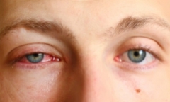 Nhiễm ký sinh trùng 