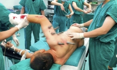 Thoát chết dù bị 10 chiếc đinh thép 