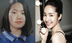 Những chuyện dở khóc dở cười sau khi chị em phẫu thuật thẩm mỹ