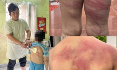 Dùng xẻng nhôm, dây sạc điện thoại đánh con trai ruột 5 tuổi, người đàn ông bị khởi tố