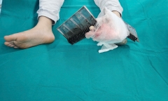 Rùng mình hai miếng sắt của thang cuốn trung tâm thương mại đâm xuyên chân bé trai 12 tuổi ở Hà Nội