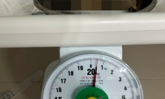 Bé 6 tuổi nhập viện vì đau bụng dữ dội, bác sĩ gắp ra thứ
