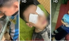 Làm rõ nguyên nhân hàng loạt học sinh ở một trường tiểu học tại Hà Nội bị dị ứng