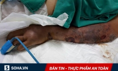 Món đặc sản người Việt rất chuộng: Dù chỉ ăn một lần cũng có thể mất mạng