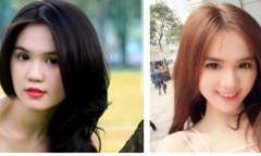 Ngọc Trinh phẫu thuật thẩm mỹ gọt cằm?
