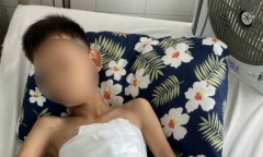 Tin tức đời sống ngày 11/2: Bé 10 tuổi bị đa chấn thương do pháo nổ