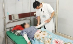 Bỏng rát vùng mặt và 2 cánh tay vì bóng bay trang trí chứa khí hydro phát nổ