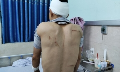 Truy bắt nhóm côn đồ mang kiếm vào bệnh viện Mắt Hải Phòng truy sát