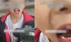 Con trai đau răng đến phát khóc, hành động kinh hãi của người bố khiến ai nấy giật mình