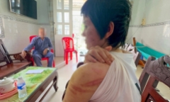 Vụ vợ bầu 7 tháng tố bị chồng bạo hành: Công an mời người chồng lên làm việc