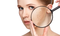 Điểm mặt 4 sai lầm khiến da nứt nẻ, khô ráp đáng sợ vào mùa đông