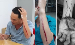 Điều tra vụ nam điều dưỡng bị người nhà bệnh nhân 