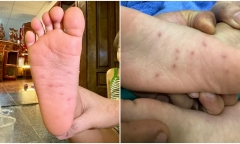 Vụ 2 bé ở Bình Định nghi bị giáo viên mầm non bạo hành: Công an vào cuộc điều tra