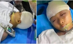 Điều tra vụ giáo viên làm học sinh chấn thương sọ não phải phẫu thuật cấp cứu