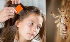 Con gái 7 tuổi bị chấy đầy đầu, cách xử lý của người mẹ khiến dân tình ngã ngửa