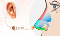 Nâng mũi bằng sụn tai là gì?
