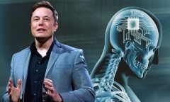 Công ty của Elon Musk tuyên bố đạt bước tiến vượt bậc trong việc cấy chip vào não người