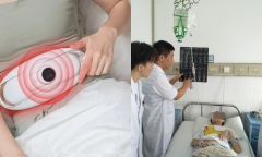 Dùng thứ này 30 phút mỗi ngày để giảm đau nhức, cô gái bàng hoàng khi nghe kết quả chẩn đoán của bác sĩ