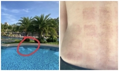 Vụ bé trai người Nhật bị đuối nước ở Phan Thiết: Vết bầm trên lưng luật sư sau 2 ngày thực nghiệm điều tra