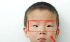 Bé trai 5 tuổi mắt thâm đen, con ngươi 1 bên gần như 