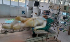 Vụ con gái phóng hỏa đốt nhà mẹ: Người mẹ trải qua 2 cuộc phẫu thuật, sức khỏe rất yếu