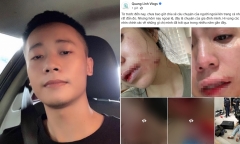 Động thái gây chú ý của Quang Linh Vlogs khi Hằng Du Mục bị chồng đánh đập dã man