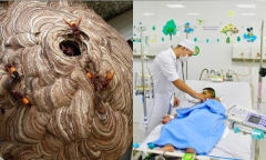 Cứu sống bé trai 8 tuổi bị ong vò vẽ đốt hơn 60 mũi đến nguy kịch