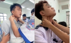 CDC Hà Nội cảnh báo nguy hiểm chết người từ trào lưu “bắt pen” trên TikTok