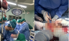  Cứu sống một bệnh nhân nguy kịch bị dao đâm thủng phổi 
