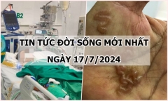 Tin tức đời sống ngày 17/7/2024: Nguyên nhân khiến nữ sinh đi cấp cứu trong đêm