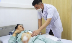 Tin tức đời sống ngày 27/4: Người đàn ông 65 tuổi bị thủng dạ dày - tá tràng hiếm gặp