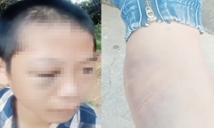 Triệu tập nhóm liên quan vụ nữ sinh bị đánh hội đồng tại Cao đẳng Việt Xô số 1